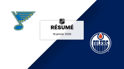 STL vs EDM | Résumé | 18/01/2026