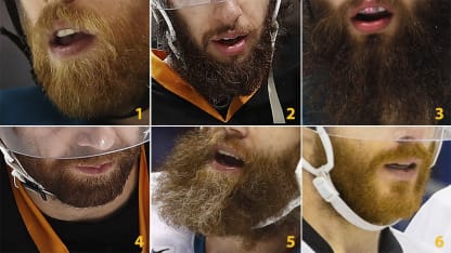 sjs-pit-scf-beard-quiz